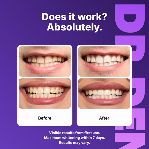 DRDENT Purple Teeth Whitening Strips