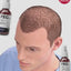 FEG Plus™ Hair Growth Spray